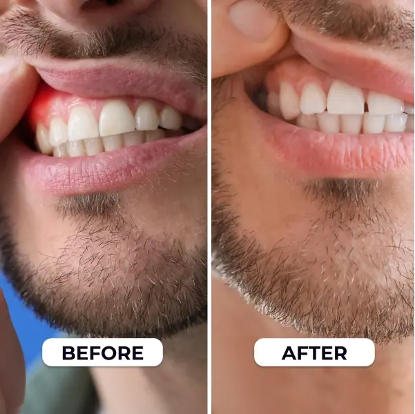 PrimeDenta Before and after